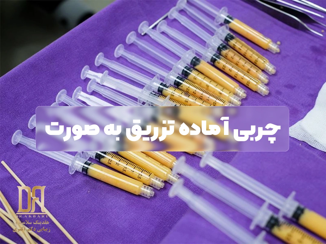 سرنگ‌های حاوی چربی آماده برای تزریق به صورت