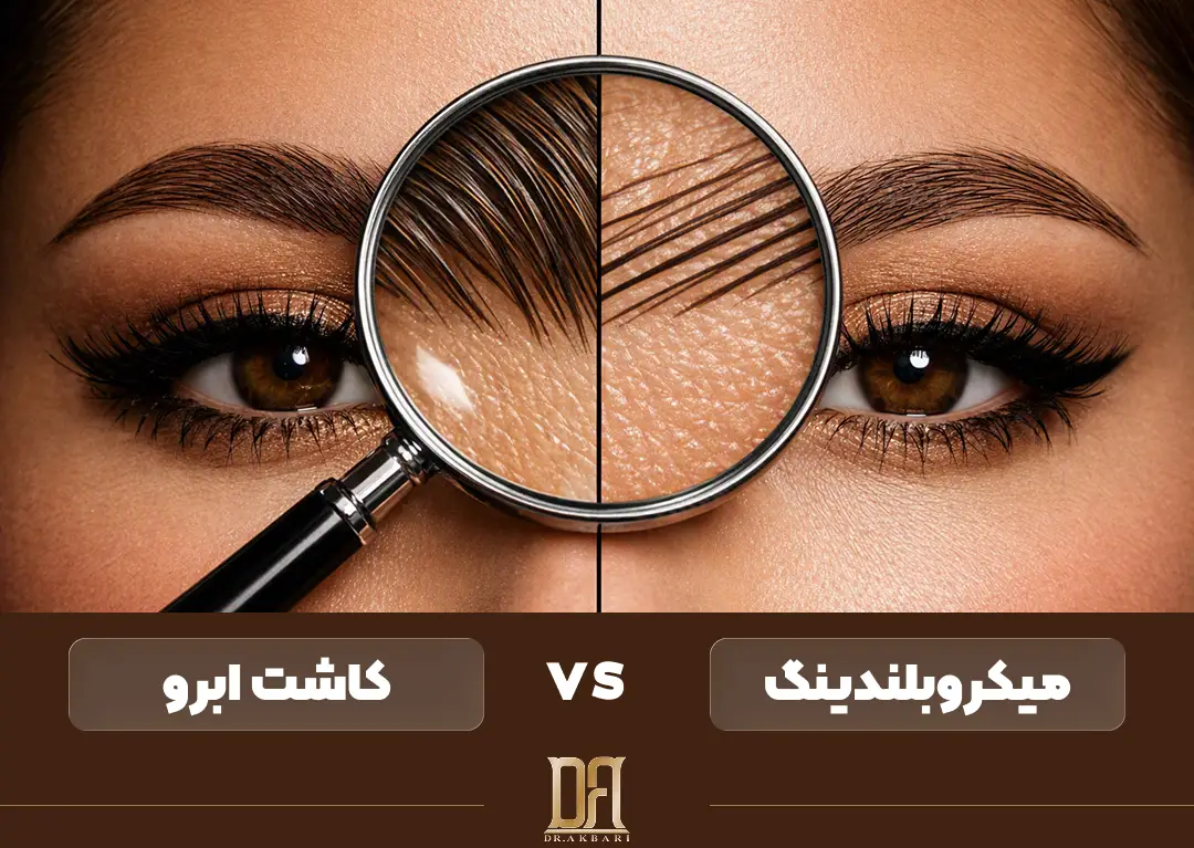 تفاوت کاشت ابرو با میکروبلندینگ