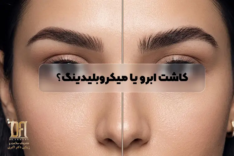 کاشت ابرو یا میکروبلیدینگ؟ کدام بهتر است؟